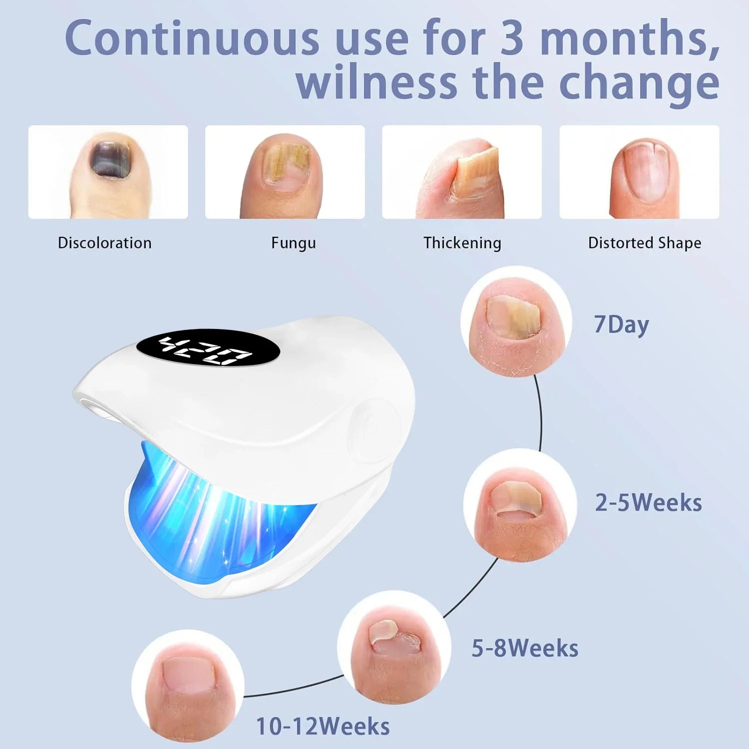 Mini Nail Fungus Laser Therapy