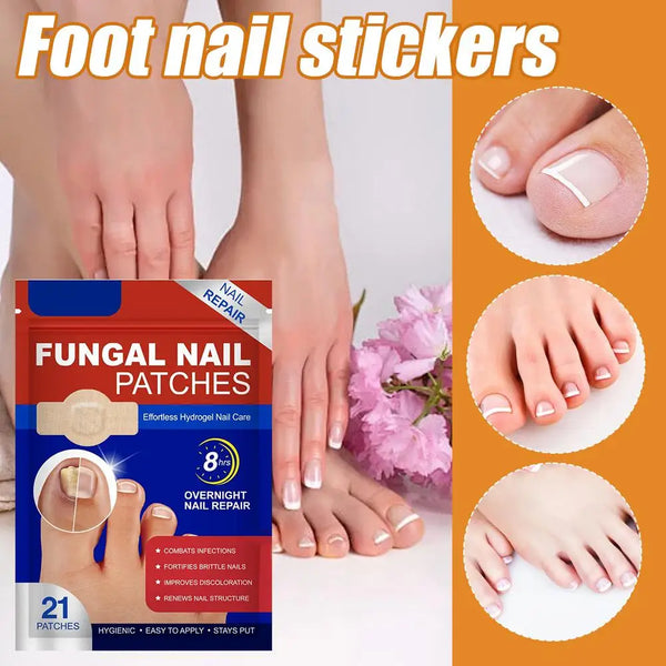Toenail-Fungus-Patch-Waterproof-Nail-Repair-Patches-Nail-Ingrown-Correction-Sticke-Fungal-Nail-Patches-Nail-Foot.jpg